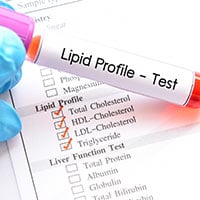 Lipid Profile Test: Why It Is Done And What To Expect