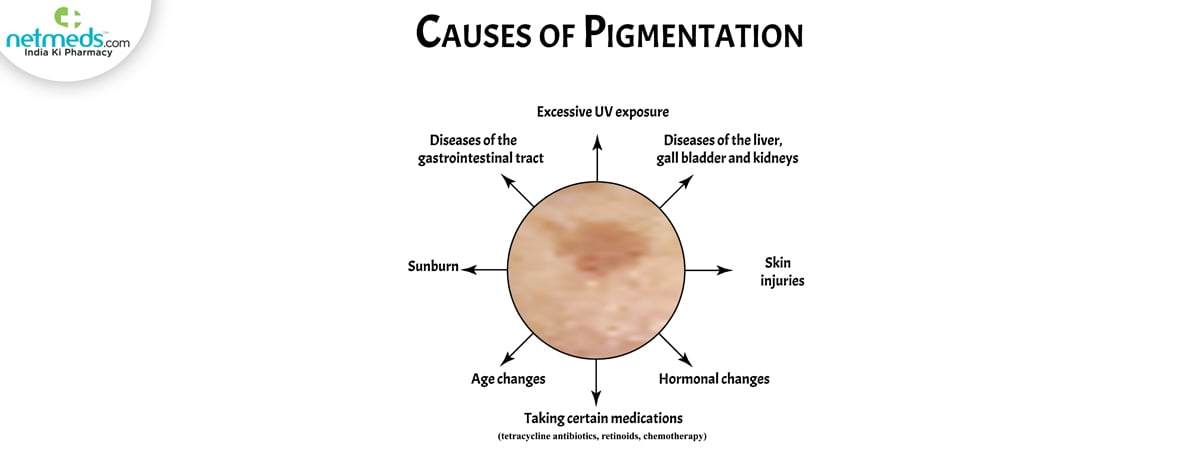 pigmentation causes