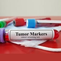 Cancer Prevention Test: Here’s How These Important Screening Examinations Aid In Combating This Lethal Condition