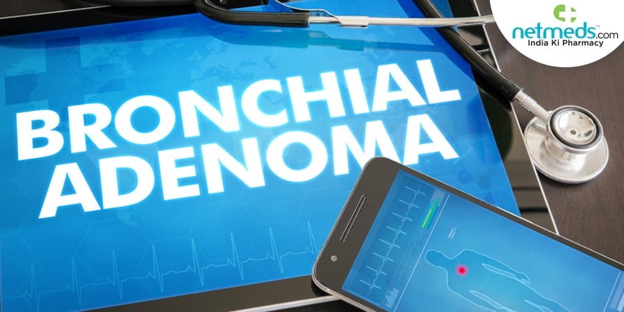 bronchial adenoma