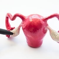 Polycystic ovary syndrome (PCOS)