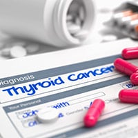 Thyroid Cancer: Causes, Symptoms And Treatment