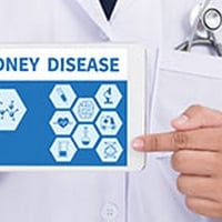 Acute Kidney Failure Can Occur Without Symptoms