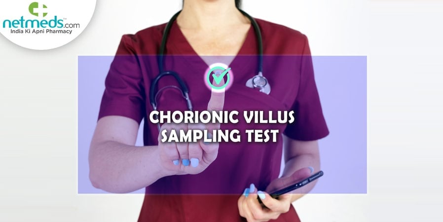 chorionic villus sampling test
