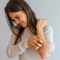 Understanding Hives: Causes, Triggers, and The Reasons Behind Sudden Disappearance Of This Skin Breakout