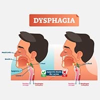 Dysphagia: Causes, Symptoms And Treatment