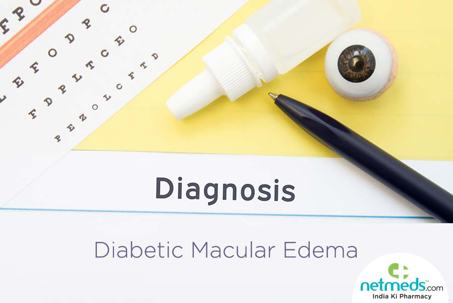 Diabetic macular edema