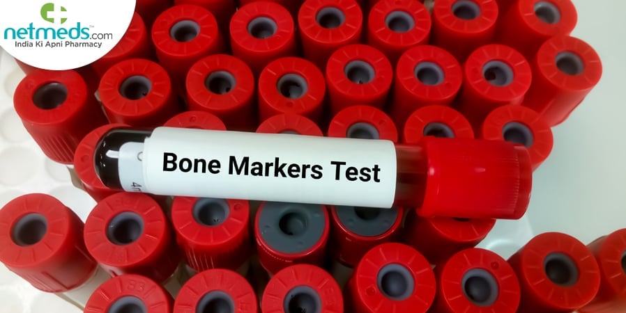 Bone Markers Test