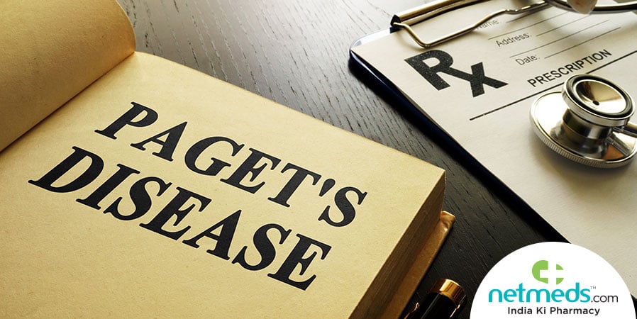 Paget's Disease Of Bone