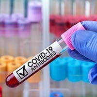 COVID Antibody Test: What Is It And Why Is It Done