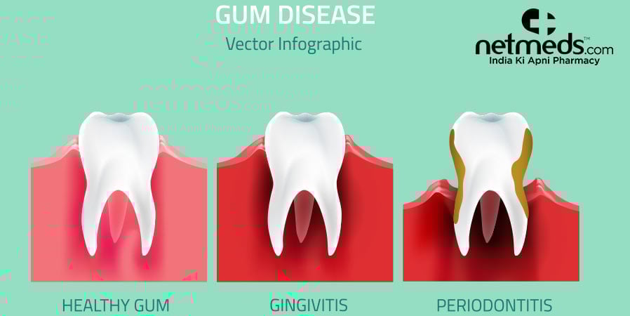 Gum disease