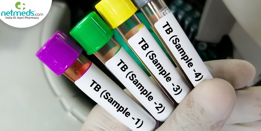 tb screening