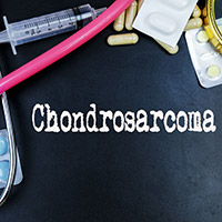 Chondrosarcoma: Causes, Symptoms And Treatment