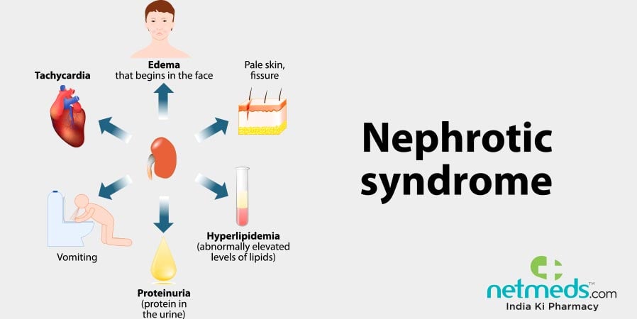 Nephrotic Syndrome