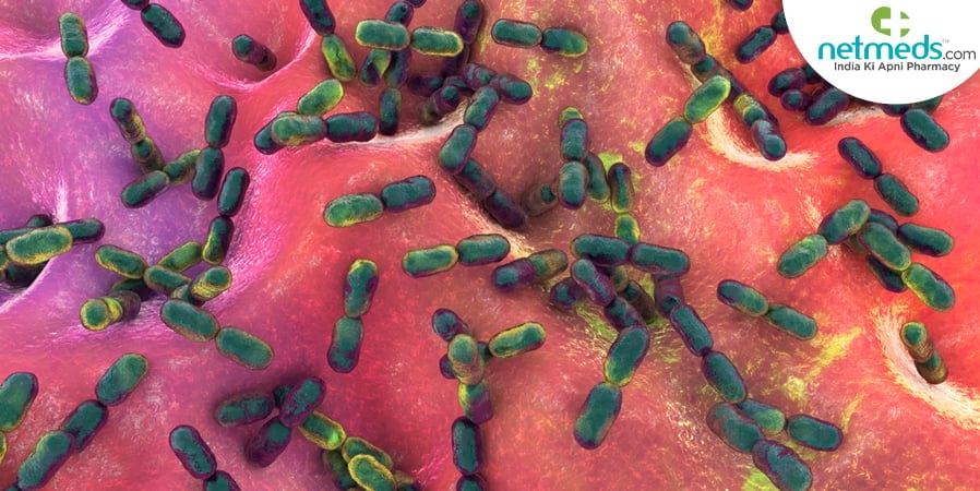 Peritonitis