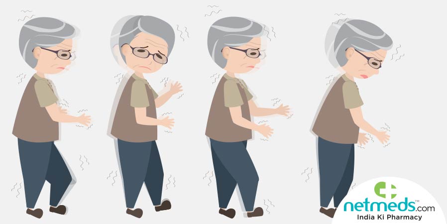 Bradykinesia symptoms