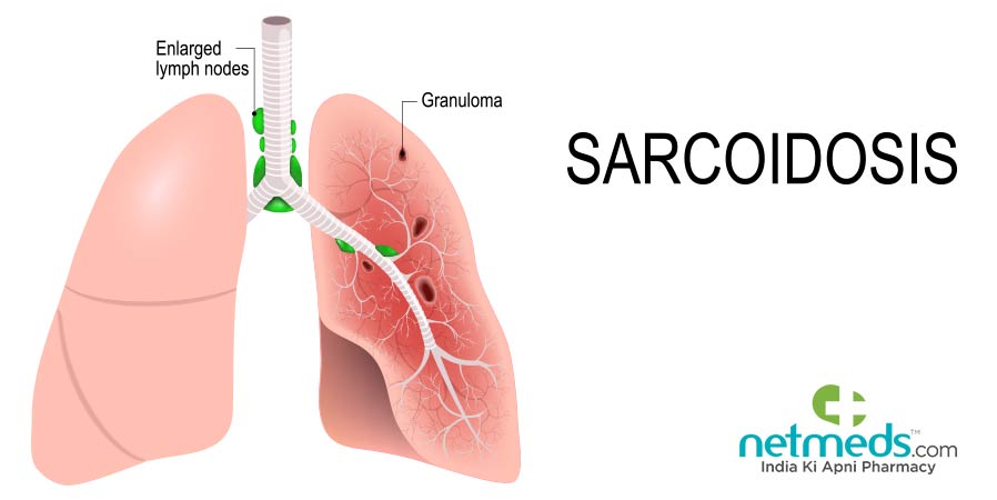 Sarcoidosis