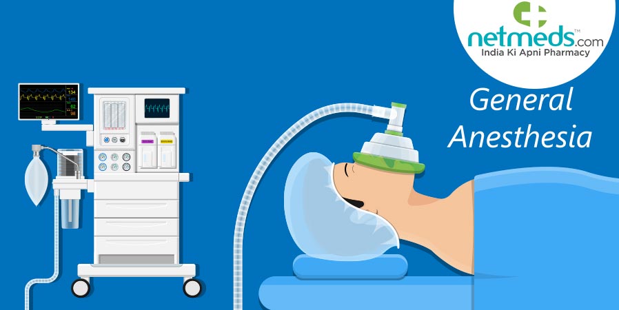 General anesthesia