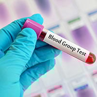 Blood Typing Test: What Is It And What To Expect?