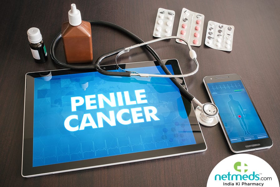 penile cancer