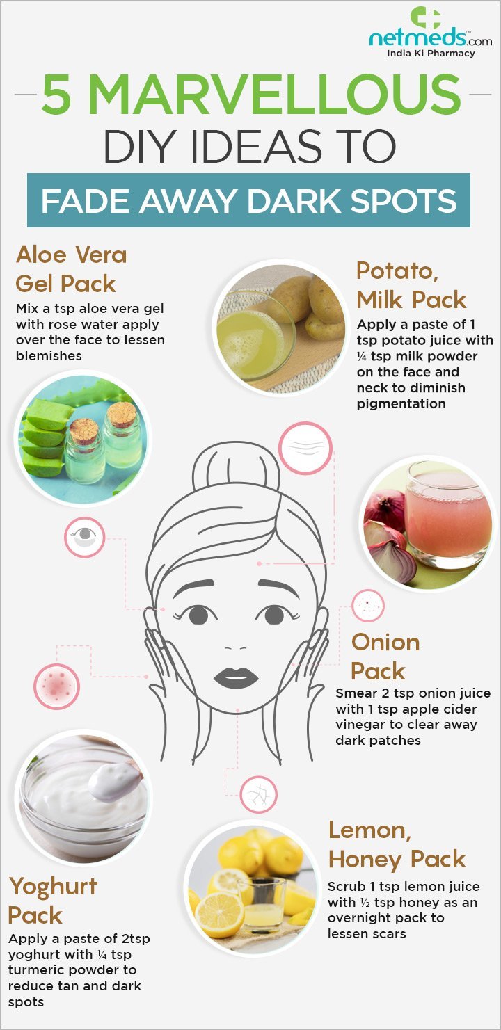5 Marvellous DIY Ideas To Fade Away Dark-Spots