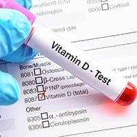 Vitamin D Test: What Is It And Why Is It Done