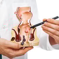 Rectovaginal Fistula: Causes, Symptoms And Treatment