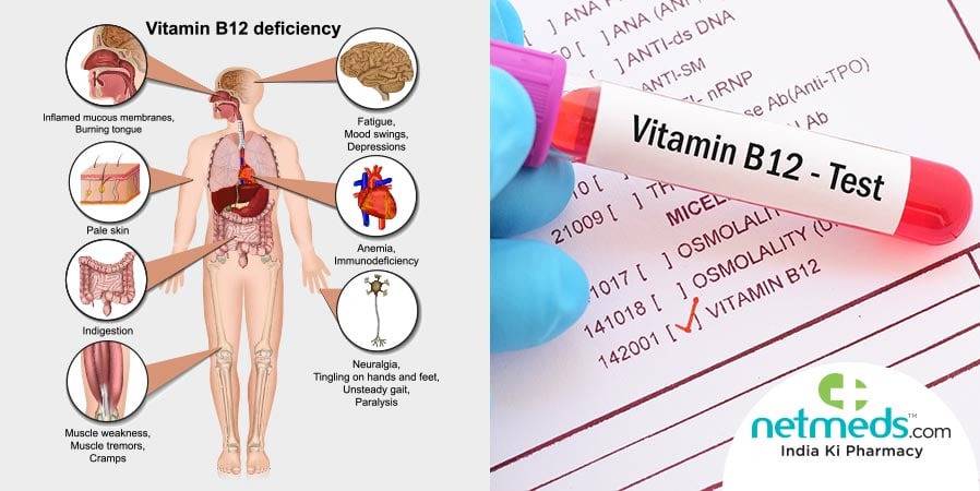 Vitamin B12 deficiency and Vitamin B12 test