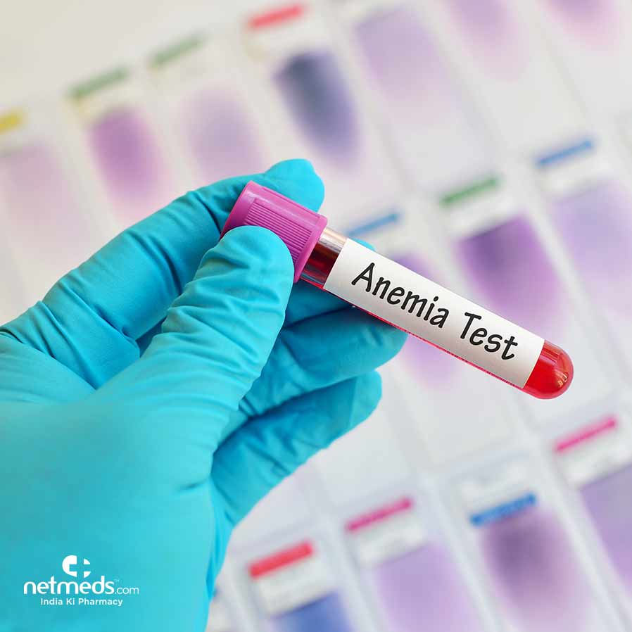 Anemia test written in a test tube
