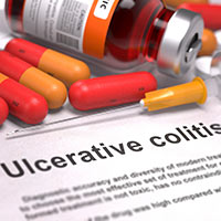 Ulcerative Colitis: Types, Symptoms And Treatment