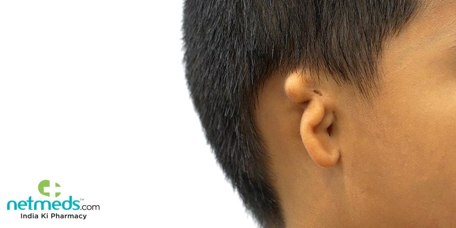Microtia