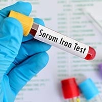 Iron Test: What Is It And What To Expect?