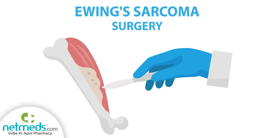 Ewings Sarcoma