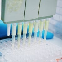 Antibody Titer Test: What Is It? Who Needs It And What To Expect? 