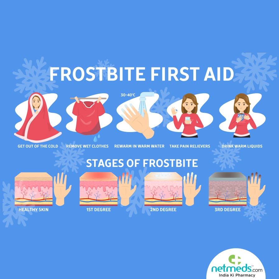 frost bite symptoms