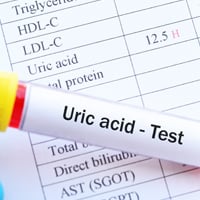 Uric Acid Test: Why It is Needed And What To Expect?