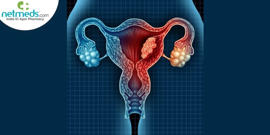 Estrogen-Dependent Cancer