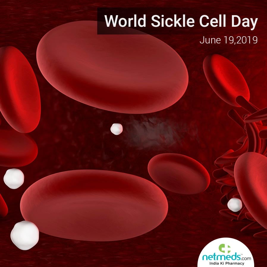 World Sickle Cell Day : Nutrition And It's Role