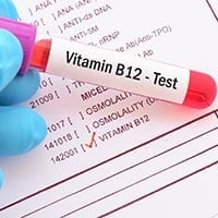Vitamin B12 Deficiency Test: What Is it And What To Expect?