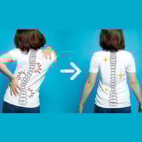Yoga For Scoliosis: 5 Proven Restorative Postures To Mitigate Pain Due To Spinal Curvature