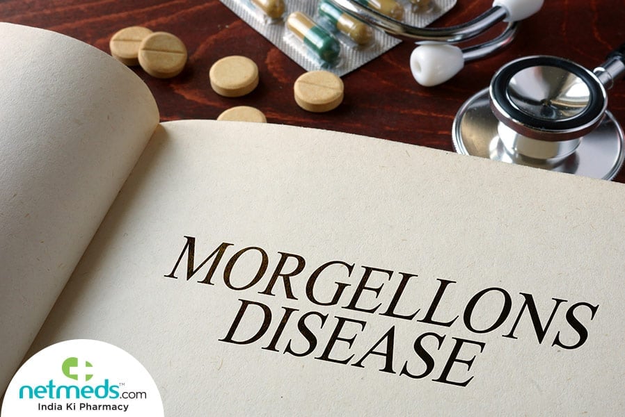 morgellons disease