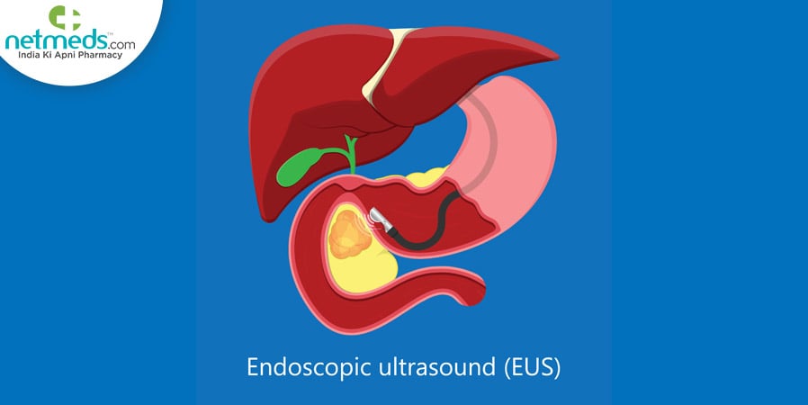Endoscopic ultrasound