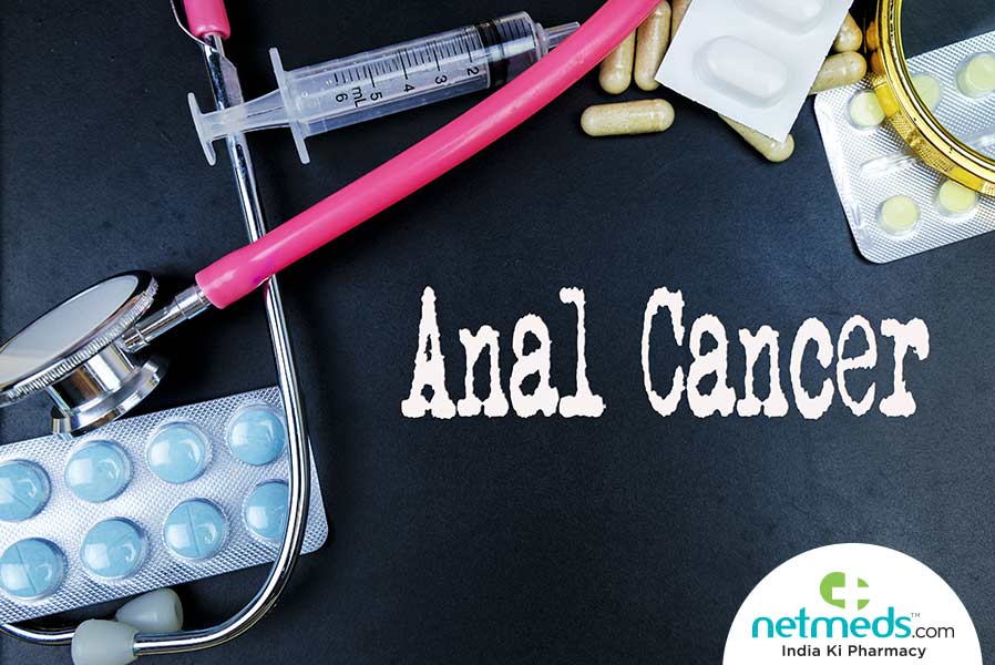 anal cancer