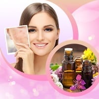 Nature’s Acne Fighters:  5 Fantabulous Essentials To Create Your Arsenal Against Pimples - Infographic