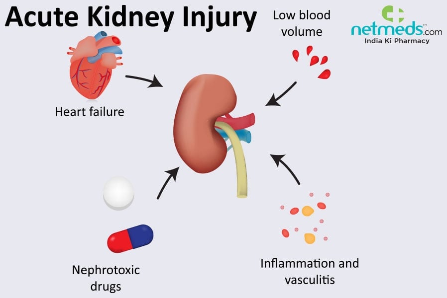 acute kidney failure