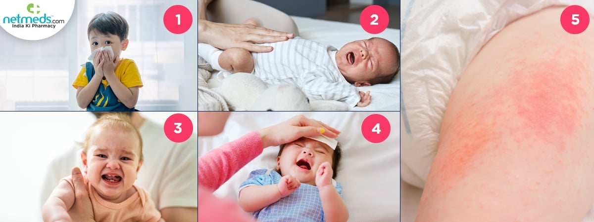 baby care remedies