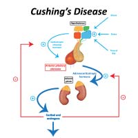Cushing Syndrome: Causes, Symptoms And Treatment