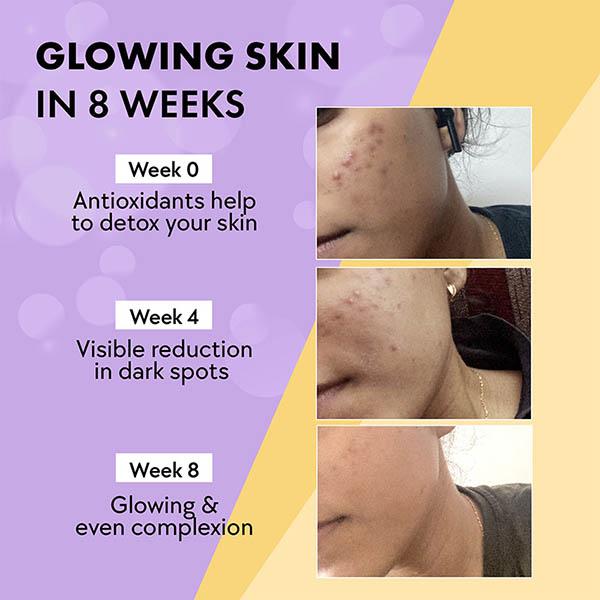 Buy Chicnutrix Glow - Japanese Glutathione and Vit C Skin Brightening -  Black Current - 20 Tablets 1's Online at Discounted Price